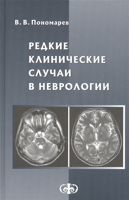 Редкие клинические случаи в неврологии (случаи из практики). Руководство для врачей
Редкие клинические случаи в неврологии (случаи из практики). Руководство для врачей