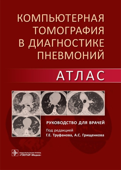 Г.Е. Труфанова, А.С. Грищенкова. Компьютерная томография в диагностике пневмоний. Атлас 2021 (978-5-9704-5946-1) Изд. ГЭОТАР-Медиа
Г.Е. Труфанова, А.С. Грищенкова. Компьютерная томография в диагностике пневмоний. Атлас 2021 (978-5-9704-5946-1) Изд. ГЭОТАР-Медиа