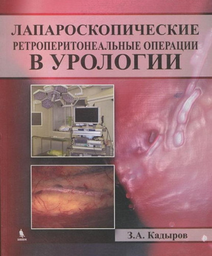 Лапароскопические ретроперитонеальные операции в урологии - Кадыров З.А. (978-5-9518-0465-5) Изд. Бином
Лапароскопические ретроперитонеальные операции в урологии - Кадыров З.А. (978-5-9518-0465-5) Изд. Бином