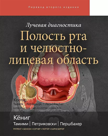 Кениг Лучевая диагностикаПолость рта и челюстно-лицевая область2021 год (978-5-91839-117-4) Изд. Издательство Панфилова
Кениг Лучевая диагностикаПолость рта и челюстно-лицевая область2021 год (978-5-91839-117-4) Изд. Издательство Панфилова