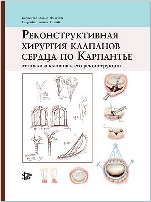 Реконструктивная хирургия клапанов сердца по Карпантье: от анализа клапана до его реконструкции
Реконструктивная хирургия клапанов сердца по Карпантье: от анализа клапана до его реконструкции