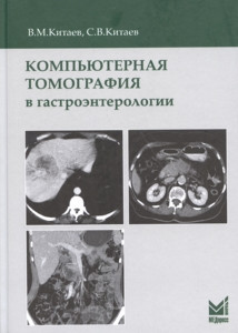 Китаев В.М., Китаев С.В. Компьютерная томография в гастроэнтерологии 2019 год (978-5-00030-704-5) Изд. МЕДпресс-информ
Китаев В.М., Китаев С.В. Компьютерная томография в гастроэнтерологии 2019 год (978-5-00030-704-5) Изд. МЕДпресс-информ