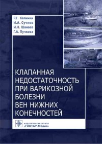 Клапанная недостаточность при варикозной болезни вен нижних конечностей (14524779)
Клапанная недостаточность при варикозной болезни вен нижних конечностей (14524779)