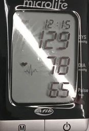 Тонометр автоматический на плечо Microlife BP A 200 Afib Original фото от покупателей 5