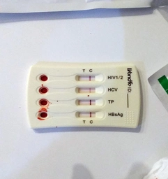 Тест на 4 інфекції: ВІЛ1/2, гепатит В, гепатит С, сифіліс Wondfo мультиинфекция 4 W026-C