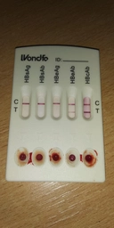 Тест на 5 маркерів гепатиту В Wondfo HBsAg, HBsAb, HBeAg, HBeAb, HBcAb - HBV W040-P фото від покупців 1