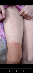 Липидовосстанавливающий бальзам La Roche-Posay Lipikar AP+Max для ухода за сухой, очень сухой и склонной к атопии кожей лица и тела младенцев, детей и взрослых 75 мл (3337875930116) фото от покупателей 14