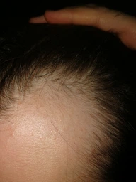 Миноксидил Folixidil Beard Booster 6% от выпадения волос, для роста волос и бороды фото от покупателей 3