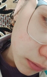 Сыворотка с ретинолом 0.5% омолаживающая CUSKIN Clean-Up Retinol Activator 0.5% 30 мл фото от покупателей 2