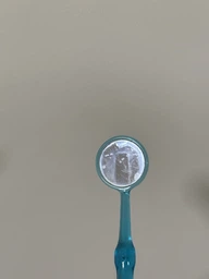 Стоматологічне дзеркало Miradent Dental Mirror для самообстеження (4250107600658)