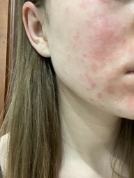 Интенсивная антивозрастная корректирующая сыворотка La Roche-Posay Ретинол Б3 против глубоких морщин, неровного тона и текстуры кожи лица 30 мл (3337875694469) фото от покупателей 2