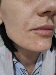 Успокаивающий крем Eucerin AtopiControl для атопичной кожи 40 мл (4005800076732)