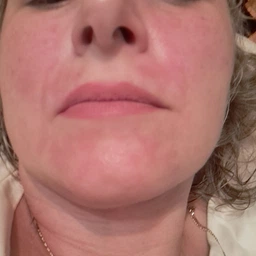 Ночная сыворотка для кожи лица L'Oreal Paris Revitalift Laser с ретинолом против глубоких морщин 30 мл (3600524229115)