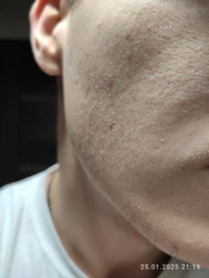 Лосьон против выпадения волос Folixidil Minoxidil medical 5% 50 мл (8032706442817) фото от покупателей 3
