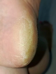 Пемза пилка для ніг та п'яток роликова аккумуляторна Callus Remover 3W електрична для шліфування електропемза для педикюру USB рожева фото від покупців 1