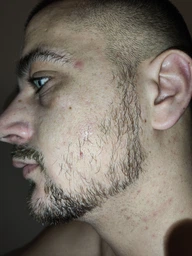 5% Minoxidil Kirkland для росту волосся та бороди (3 флакона + дозатор) фото від покупців 11
