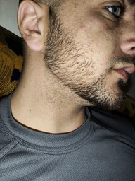 5% Minoxidil Kirkland для росту волосся та бороди (3 флакона + дозатор) фото від покупців 9