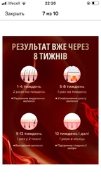 Фотоепілятор жіночий лазерний епілятор 360 градусне охолодження регулювання інтенсивності безболісний компактний для тіла рук обличчя зони бікіні і ніг фото портативний домашній фото від покупців 4