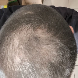 Лосьон против выпадения волос Folixidil Minoxidil medical 5% 50 мл (8032706442817)
