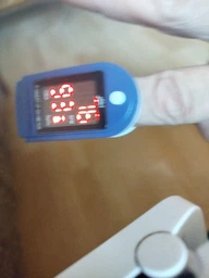 Пульсоксиметр Pulse Oximeter Jziki jzk-302 пульсометр электронный на палец оксиметр
