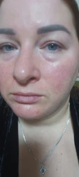Увлажняющий тонер SKIN1004 Madagascar Centella Toning Toner с азиатской центеллой 30 мл (8809576261196)