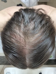 Сыворотка L'Oreal Paris Elseve Growth Booster для борьбы с выпадением и ломкостью волос 102 мл (3600524198367) фото от покупателей 1