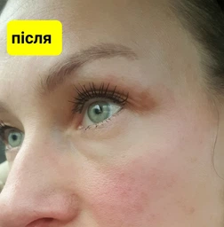 Пигментный Отбеливающий Крем с Гидрохиноном 4% 30 грамм | Abbott Hydroquinone Cream USP Melalite Forte | Expigment | Мелалит фото от покупателей 5
