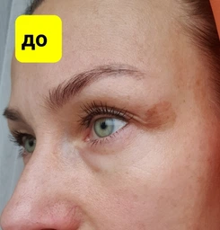 Пигментный Отбеливающий Крем с Гидрохиноном 4% 30 грамм | Abbott Hydroquinone Cream USP Melalite Forte | Expigment | Мелалит фото от покупателей 4