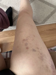 Массажер вакуумный 6 режимов Cupping Massage Pro аккумуляторный + масло 1 шт зеленый фото от покупателей 9