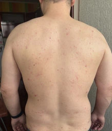 Мыло-уход для глубокого очищения кожи лица Biotrade ACNE OUT 100 г (3800221840204) фото от покупателей 2