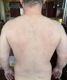 Мыло-уход для глубокого очищения кожи лица Biotrade ACNE OUT 100 г (3800221840204)