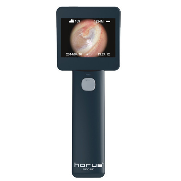 Отоскоп цифровий MIIS EOC100 Horus Digital Otoscope Full HD для діагностики слухового каналу (mpm_00255) - зображення 1