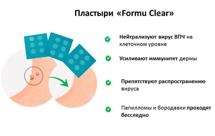 Пластыри Formu Clear от папиллом и бородавок 30 штук - изображение 2