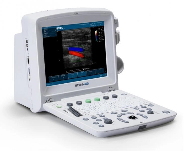 Ультразвуковая диагностическая система Edan U50 Prime Edition - изображение 1
