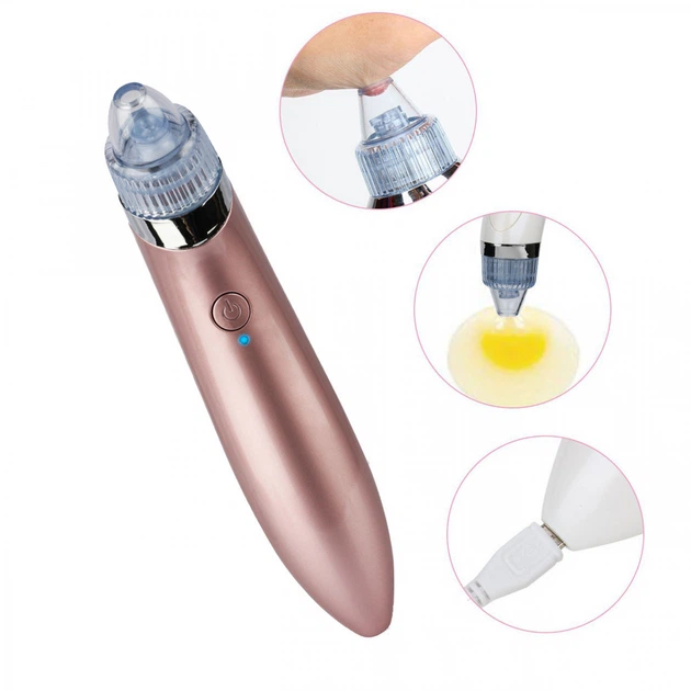 Вакуумный очиститель кожи Menqahahayd XN-8030 Pink - изображение 3