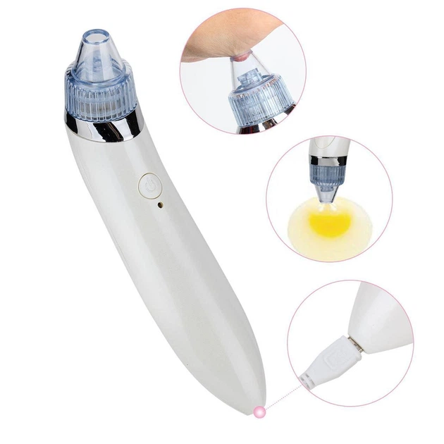 Аппарат для вакуумной чистки лица Beauty Skin Care Specialist XN-8030 белый - изображение 3