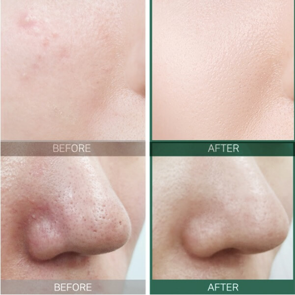 Тонер SOME BY MI AHA-BHA-PHA 30 Days Miracle Toner кислотный отшелушивающий, 30 мл - изображение 2