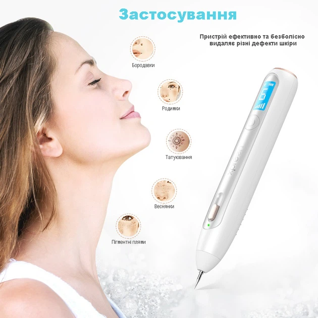 Электрокоагулятор плазменный XPREEN 051 с беспроводной зарядкой прибор для удаления папиллом и бородавок (7393) - изображение 3