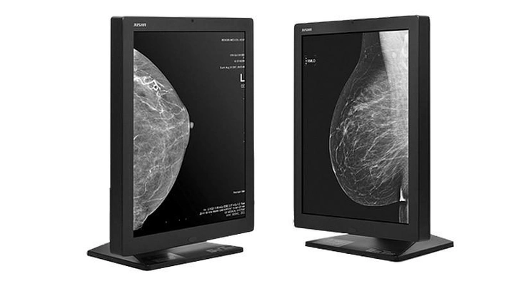 Мамографічний медичний монітор JUSHA-M53 (5МП, монохромний, діагональ 21,3 дюйми, для рентгенографії, мамографії, МРТ, КТ, ангіографії) - зображення 1