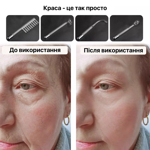 Профессиональный дарсонваль для ухода за волосами и лицом V1-002 Белый - изображение 9
