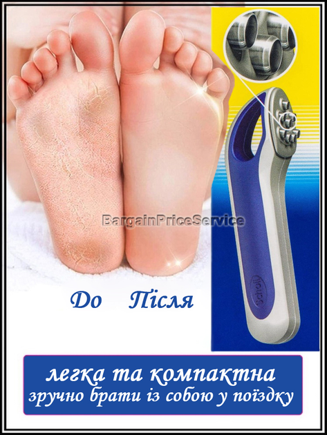 Scholl Instant Hard Skin Remover