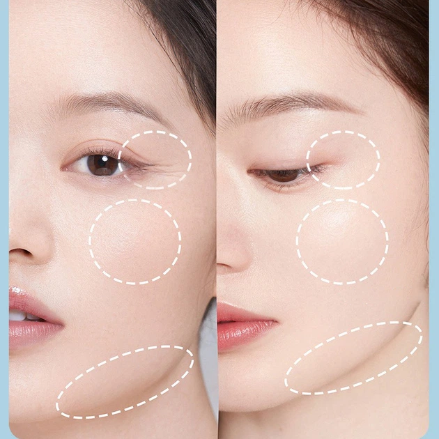 Лифтинг массажер для лица и тела A-plusFace Light Line Lifting для разглаживания морщин с отпаривателем - изображение 3
