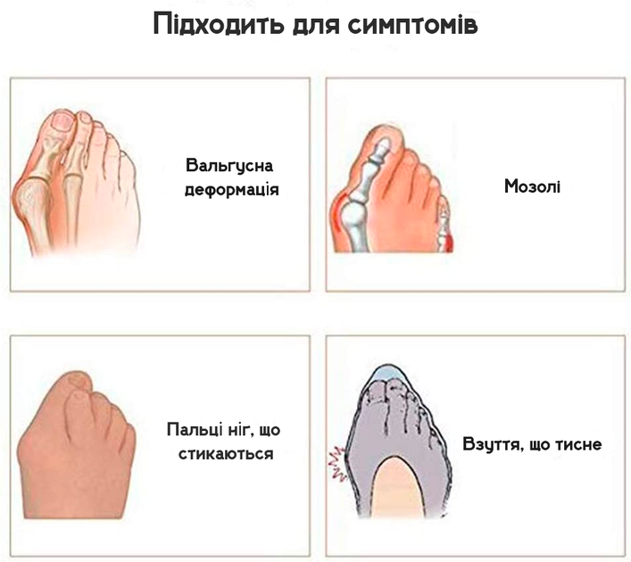 Силіконовий коректор-роздільник для пальців ніг Clefers ToeSep 35- Лікування кісточки (500448) 1 пара - зображення 4