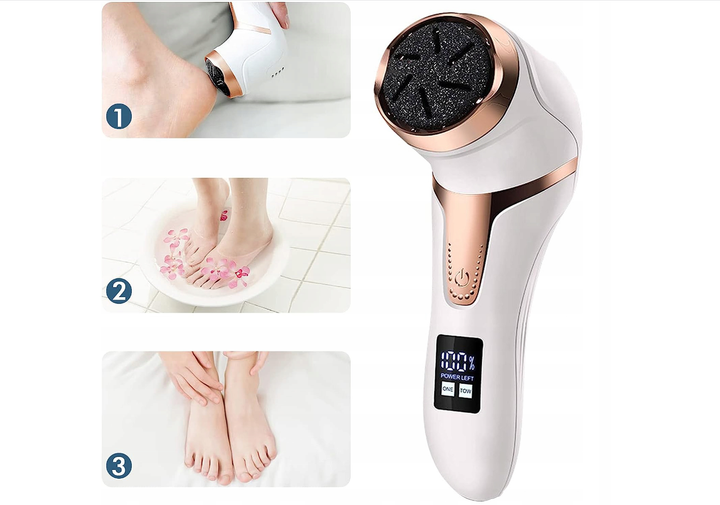 Электрическая пемза для удаления мозолей стоп Callus Remover mt 510 - Фото 7 Электрическая пемза для удаления мозолей стоп Callus Remover mt 510 - изображение 7