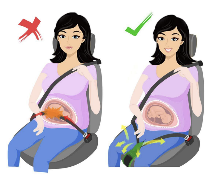 Универсальный адаптер автомобильного ремня безопасности SUNROZ Pregnancy Seat Belt для беременных Черный - изображение 5
