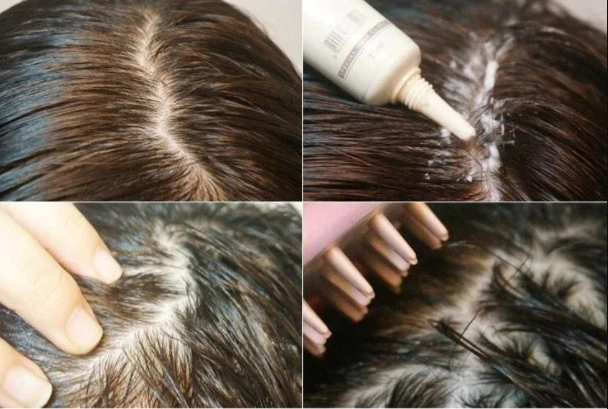 Сироватка-пілінг для шкіри голови La'dor Scalp Scaling Spa Ampoule 15 ml - зображення 2