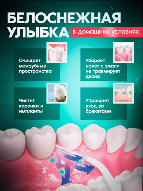 Ирригатор для полости рта USB 230 мл Portable Oral Irrigator / Портативный ирригатор для зубов - изображение 2