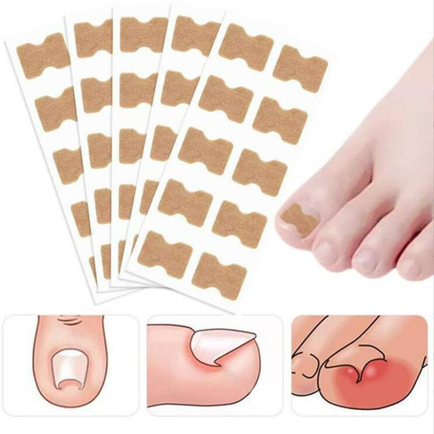 Пластир для корекції врослого нігтя Toenail Correction Sticker 20 шт - зображення 1