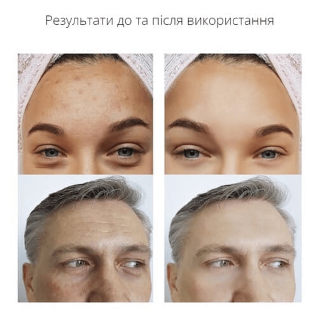Портативний дарсонваль MEDICA+ DARSOLINE 7.0 (Японія) - зображення 8