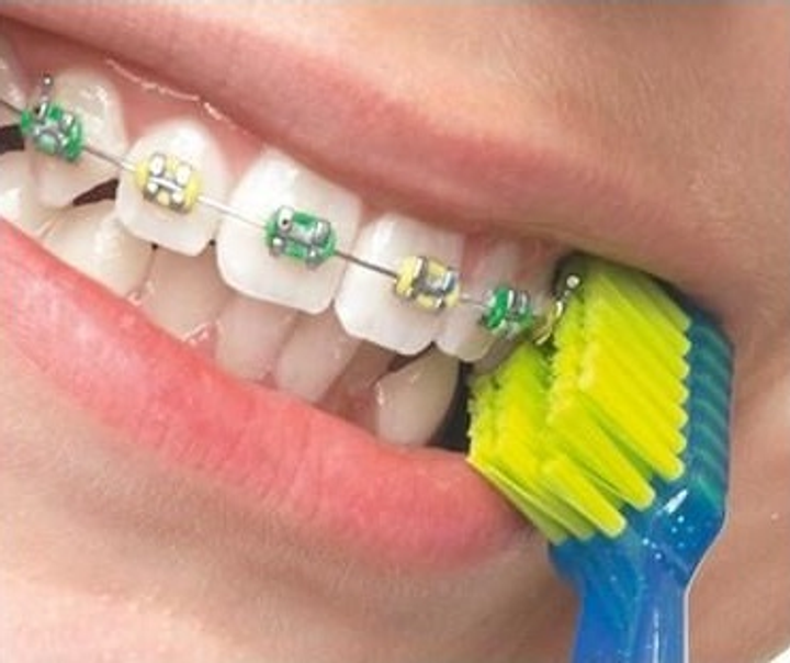 Набір Curaprox Ortho Kit ортодонтичний (7612412424515) - зображення 5